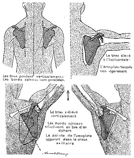 bras