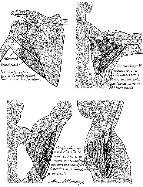bras1